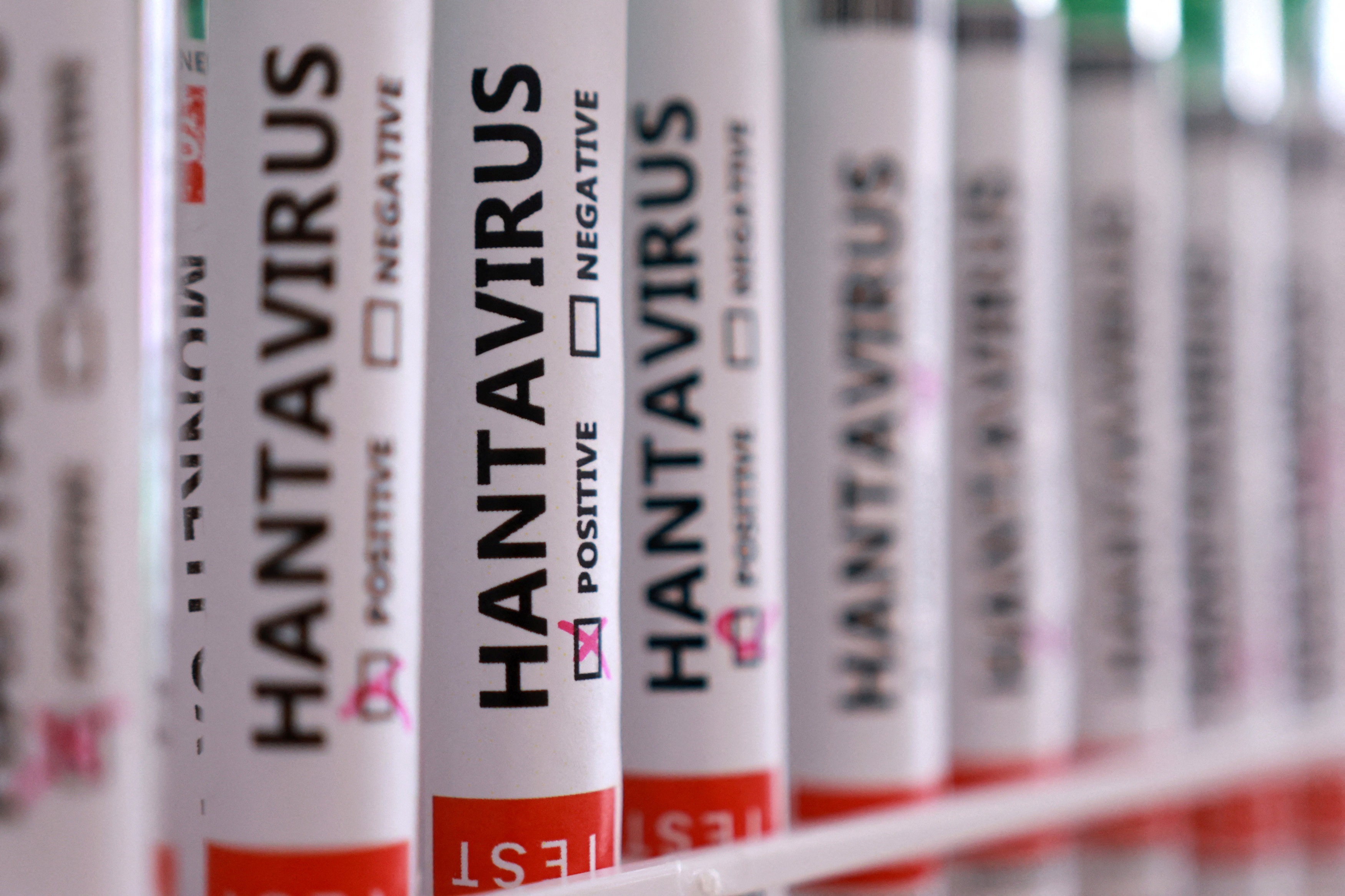 hantavirus-panigi-hollandali-kabin-memurunun-testi-negatif-cikti-ZuRTJSIH.jpg